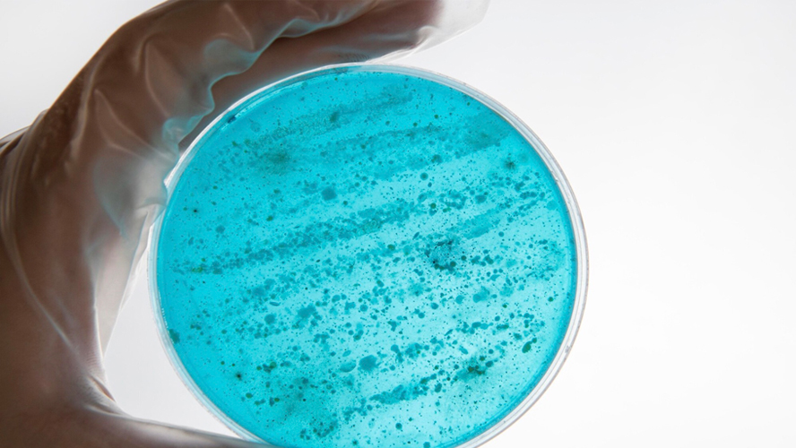 HYGIENEINSPEKTION GEM. VDI 6022 | MIKROBIOLOGISCHE UNTERSUCHUNG, LUFTKEIMMESSUNG...